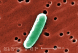 Escherichia coli (E. coli): Content provider: CDC/ Janice Haney Carr Source: CDC, Public Health Image Library Image ID # 10577